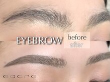 エサージュ 新宿店/ビフォーアフター２