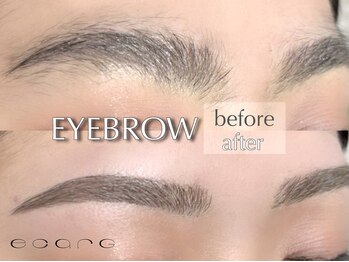 エサージュ 新宿店/ビフォーアフター２