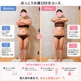 ラディアボディ四十瀬