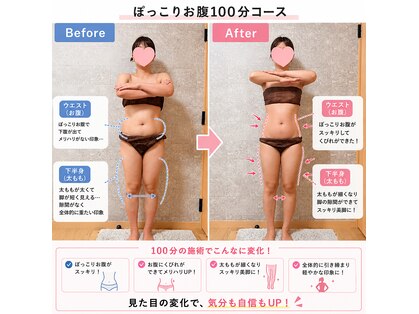 ラディアボディ四十瀬の写真