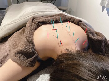 ナウリラックス鍼灸所【美容鍼/肩こり/腰痛/鍼灸/不眠改善/フェイシャル】の写真/専門知識と高技術で不調を根本改善!【本格鍼灸・美容鍼】でお客様の心と身体のお悩みに深く寄り添います