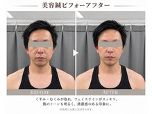 あっぱれ東洋鍼灸院の雰囲気（美容鍼後はフェイスラインスッキリ！メンズの方々も是非♪）