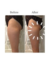 ウナ デ リンゴル 恵比寿店(UNA de Ringol)/スッキリ美脚に！ボディ痩身