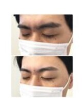 アイビー 神保町店(i.b)/眉【before⇒after】４９