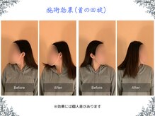 ボディ リセット アンド デザイン(Body Reset & Design)/【施術例】ビフォーアフター