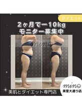 ミノ 美里大通り店(mino)/ダイエットパッケージ