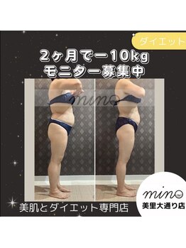 ミノ 美里大通り店(mino)/ダイエットパッケージ