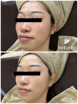 ジャスミン(Jasmin)/モイスチャーフェイシャル