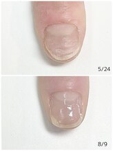 ルクレール カシェット(Le clair cachette)/美爪育成ケアコース