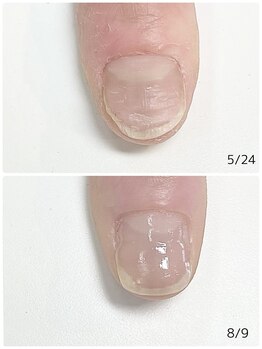 ルクレール カシェット(Le clair cachette)/美爪育成ケアコース