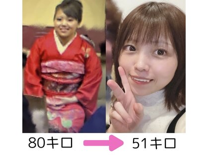 ヨサパーク ホイミ(YOSA PARK)の写真