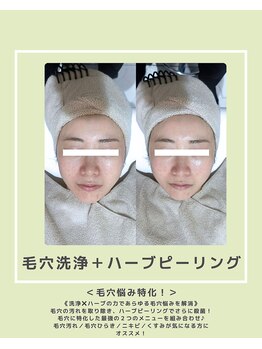 ソワナ(soina)/【神楽坂駅/フェイシャル/毛穴】