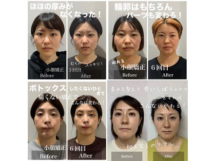 ニコ(NICO)の写真