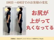 ピーチ(Peach)/骨盤矯正×トレーニング