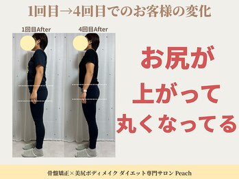 ピーチ(Peach)/骨盤矯正×トレーニング