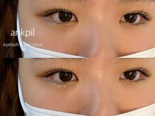 アノカプイル(ankpil)/【まつげパーマ】