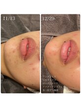 エクラ(eclat)/クリスティーナ