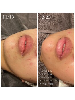 エクラ(eclat)/クリスティーナ