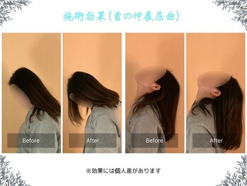 ボディ リセット アンド デザイン(Body Reset & Design)/【施術例】ビフォーアフター