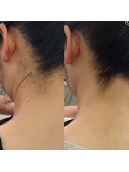 スイ 四条烏丸(SUI)/うなじ