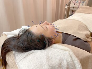 こじま 富雄団地接骨院/ヒト幹細胞美容鍼