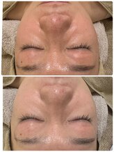 ルアナ(LUANA)/1回でトーンアップ！