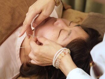 吉宗指圧治療院の写真/国家資格保持★《美容鍼×低周波電流》で徹底リフトアップ！美容鍼で内側から理想の小顔へ◎