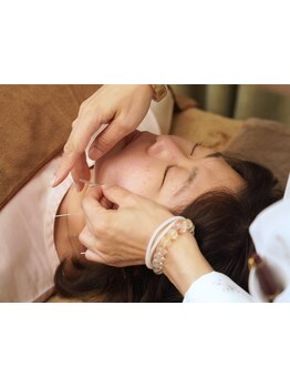 鍼灸施術を受けたい