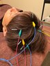 【頭痛、睡眠質の低下】頭皮鍼30分＋ドライヘッドスパ10分　