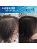 【育毛促進】プロセルセラピーズ頭皮トリートメント