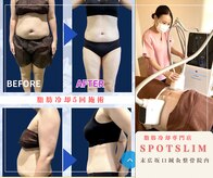 スポットスリム(SPOT SLIM)