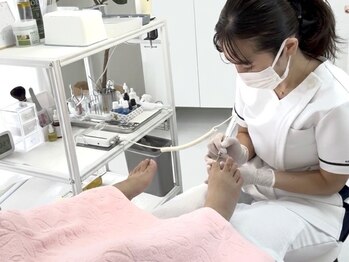 名古屋巻き爪専門 Proの写真/【かかと角質ケア￥3300】ガサガサかかとをふわふわ・ツルツルに♪自分では難しい頑固な角質もお任せ！