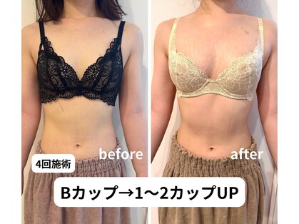 リソラ(risora)の写真