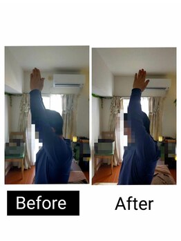 アース エンジェル整体院/ビフォアフ 肩こり ストレッチ