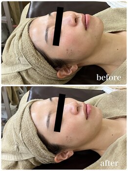 ジャスミン(Jasmin)/モイスチャーフェイシャル