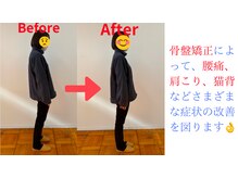 あかつき整骨院 雀の宮駅前院/姿勢改善♪