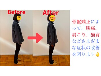 あかつき整骨院 雀の宮駅前院/姿勢改善♪