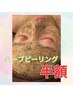 8月【平日13時まで限定】REVIハーブピーリングが半額！¥11,000→¥5,500
