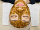 リバース 大波止店の写真/毛穴詰まり&黒ずみ徹底改善!【剥けないハーブピーリング×毛穴洗浄】ダウンタイム無しで毛穴レス美肌。