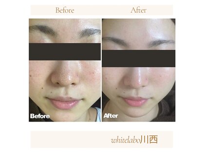 ホワイトラボ 川西(White labo)の写真