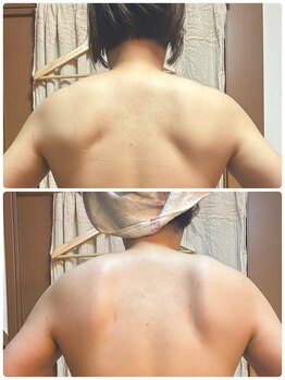 ハーモニー(Harmony)/肩甲骨の形変わると可動域アップ