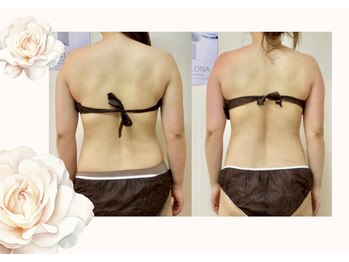 スマイルデイズ(Smiledays)/お試し施術♪