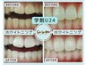 【セルへホワイトニング】再来の方学割U24セルフホワイトニングトーンアップ