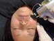縁(エニシ)の写真/TVでも紹介！【医療機関監修】とにかく希少な臍帯幹細胞を使った新menu導入☆圧倒的な効果に大満足♪