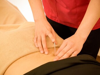 松戸駅西口整骨院/鍼灸施術