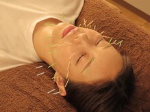 アクア鍼灸整骨院 錦糸町院/たるみ・むくみにアプローチ！