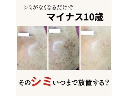 ワックスサロンアトリア(wax salon ATRIA)の写真