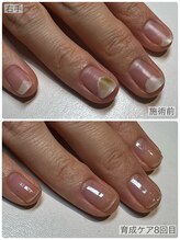 ケアリ(CAREri)/あなたのお悩みに寄り添ったケア