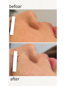 グラサヴォーグ 金沢店/毛穴すっきり滑らか肌に