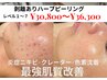 【初回剥離あり/レベル１～7】赤ニキビ/凹凸/肌荒れ痕/長年のニキビのお悩み